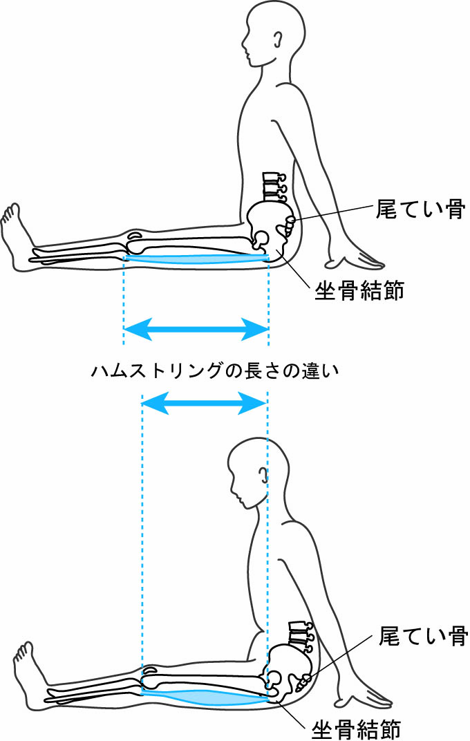 ストレッチは筋肉を知ることから始まる 沖縄県那覇市 整体 新しい整体院