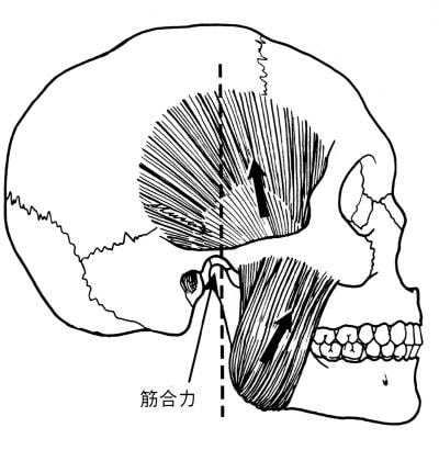 開口障害